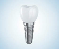 Акция! 4 импланта по цене трёх